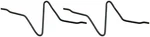 Disc Brake Anti-rattle Clip Dorman HW5420. Fixed Price $9.86.